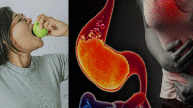 Photo of इन 5 हेल्थ कंडीशन वाले लोगों को नहीं खाना चाहिए अमरूद