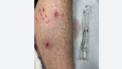 Photo of बाइक सवार युवक पर चढ़ाई कार, टांग में मारी गोली