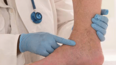 Photo of पैरों में दिखते हैं खराब ब्लड सर्कुलेशन के ये 3 लक्षण