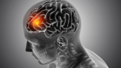Photo of देश में तेजी से बढ़ रहीं न्यूरोलॉजिकल बीमारियां